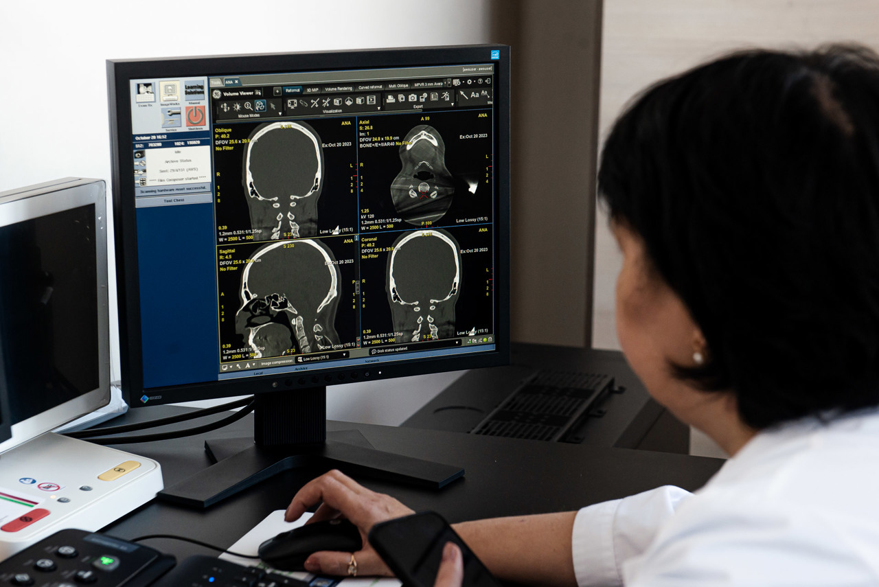 Partenerii externi donează instituțiilor medicale din Republica Moldova zeci de defibrilatoare pentru restabilirea ritmului cardiac