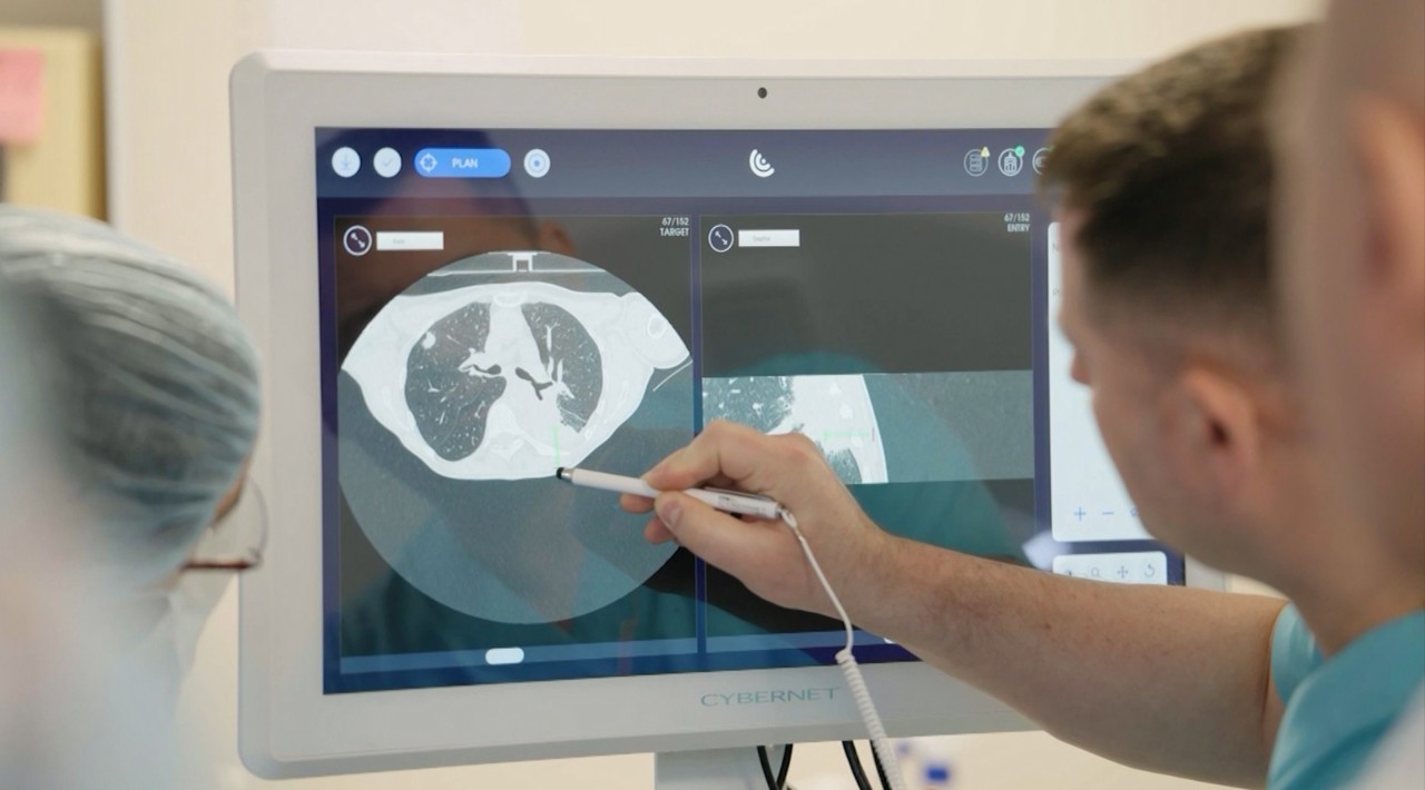 Premieră medicală | Primele intervenții robotizate de prelevare a biopsiilor pulmonare, realizate de medicii de la Chișinău  