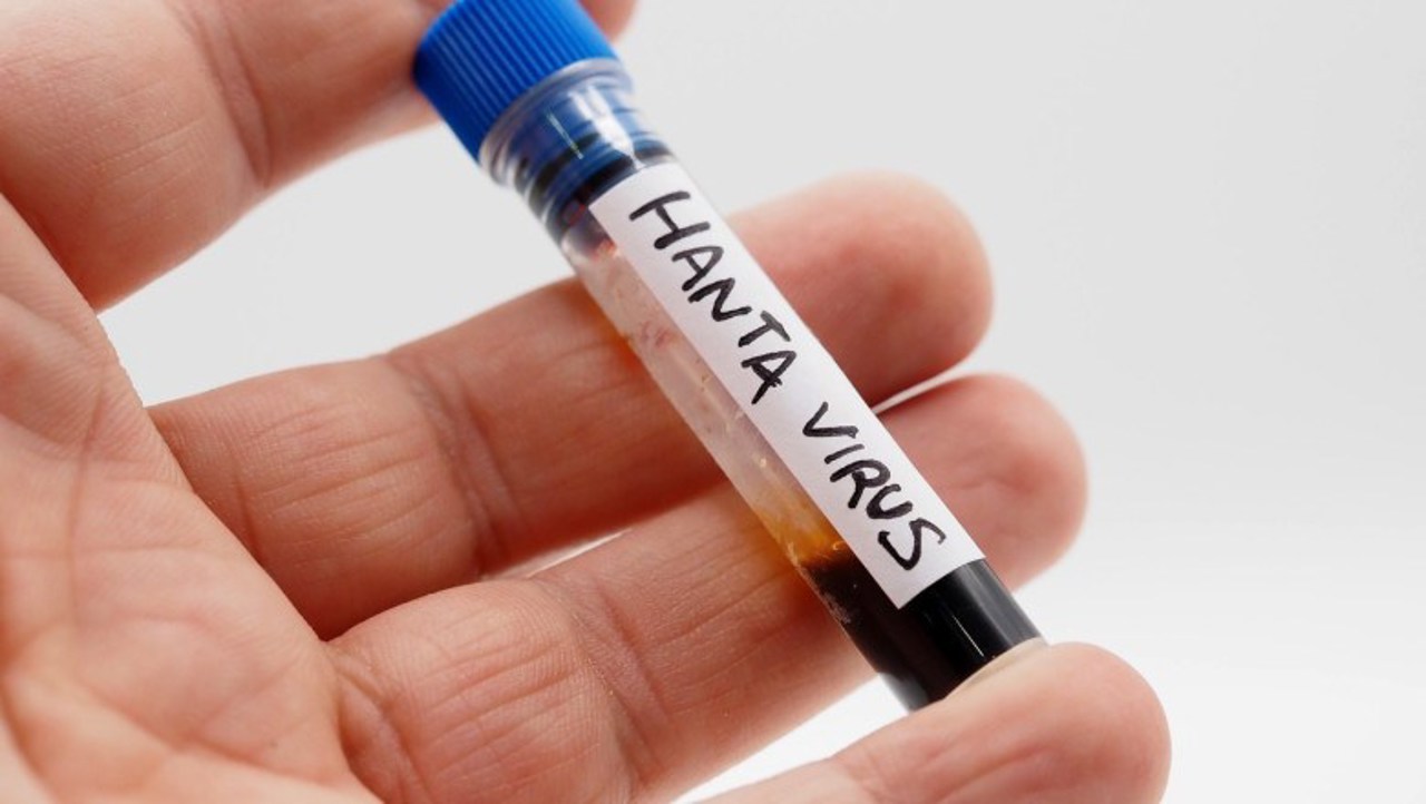 Travelers from Hantavirus-risk areas urged to seek medical advice