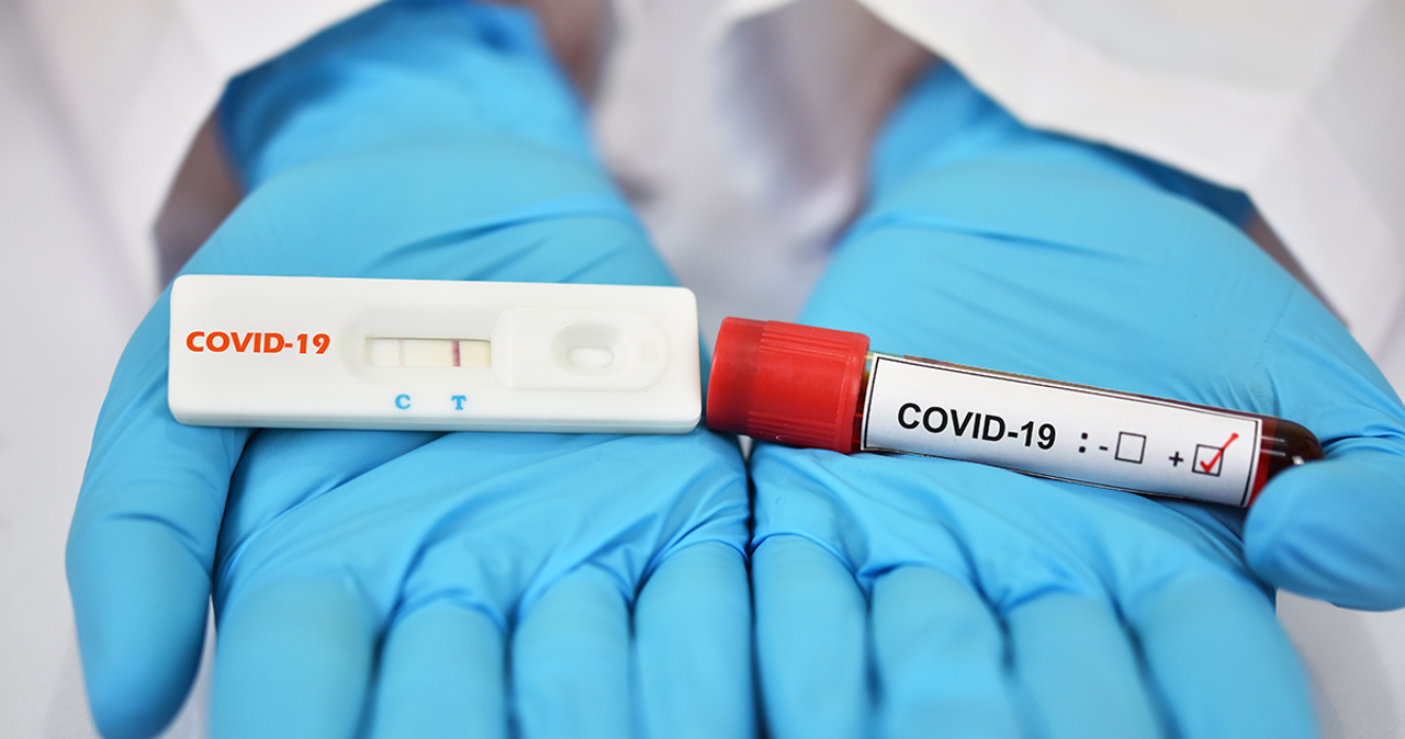 Number of  COVID-19 cases is increasing in Chisinau