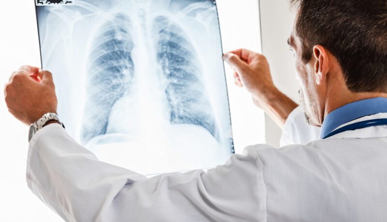 Doctorul familiei// Cele mai frecvente patologii pulmonare