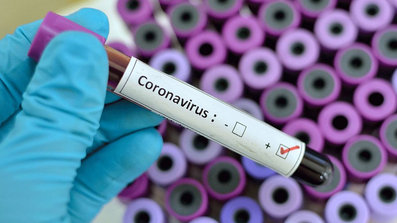 Crește numărul cazurilor de COVID-19 în R. Moldova: Recomandările autorităților pentru controlul infecției