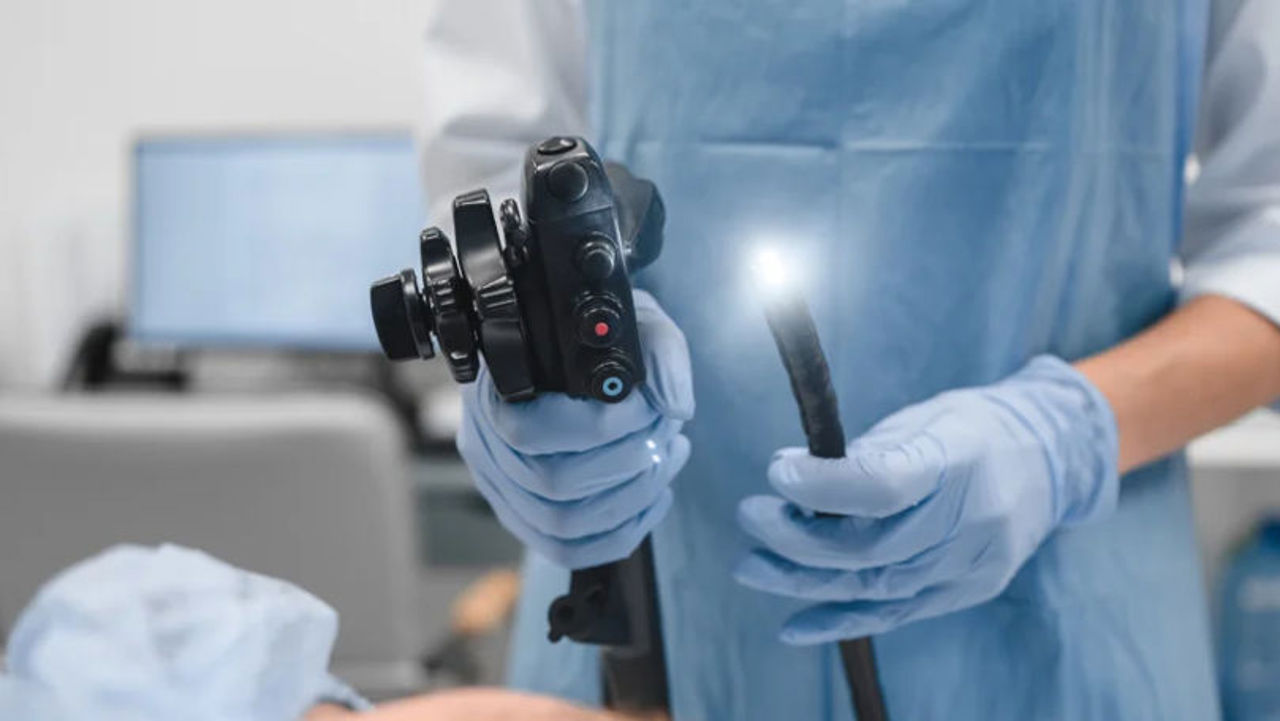 Mii de persoane testate pentru cancer colorectal în 2025, cu rezultate pozitive în sute de cazuri