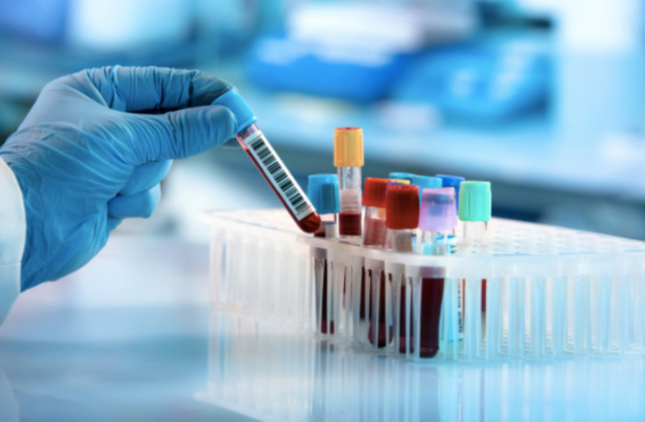 Programul național de răspuns la HIV și hepatite, aprobat de Guvern: Mai puține drumuri la Chișinău pentru pacienți