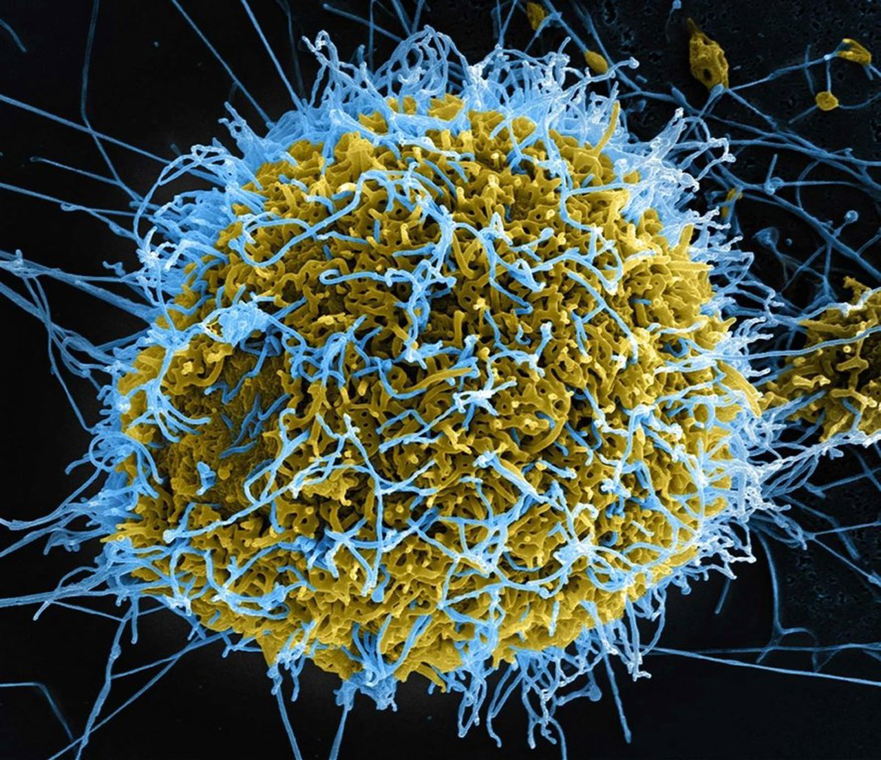 Epidemia de Ebola în Republica Dominicană Congo: 204 decese și riscul extinderii în zece țări africane