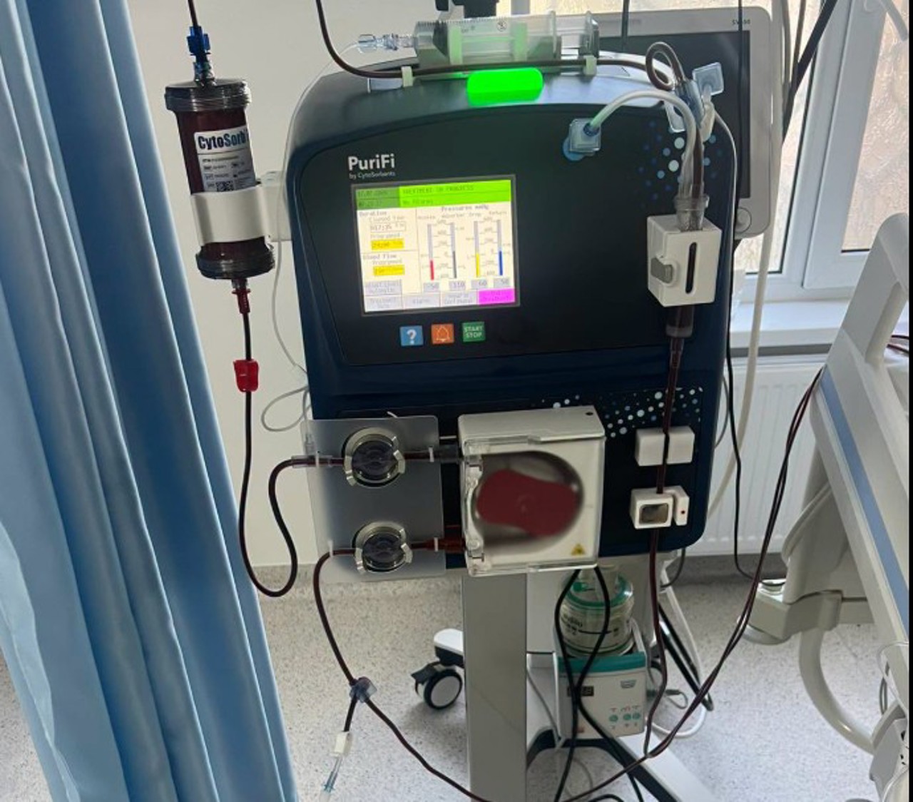 Doctors in Moldova successfully deploy CytoSorb to treat sepsis