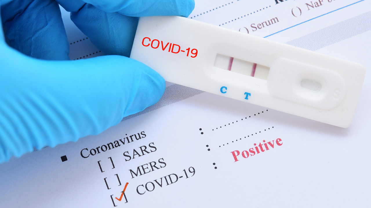 Все больше людей заражаются вирусом COVID-19 в Кишинэу. Три человека умерли