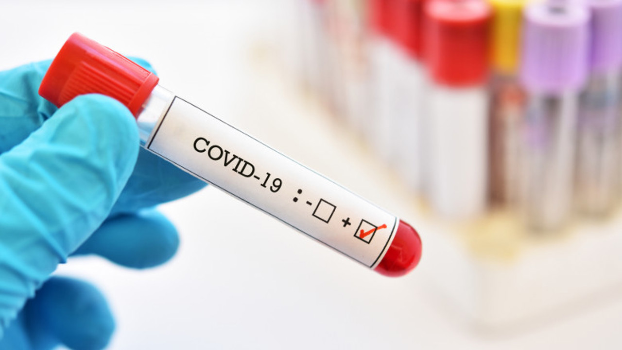 COVID-19 cases in Moldova surge fivefold in August