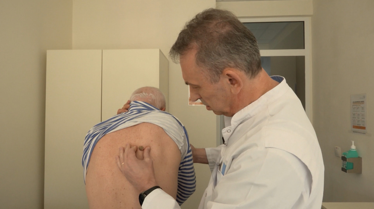 Alunițele suspecte, un semnal de alarmă: Specialiștii avertizează asupra melanomului