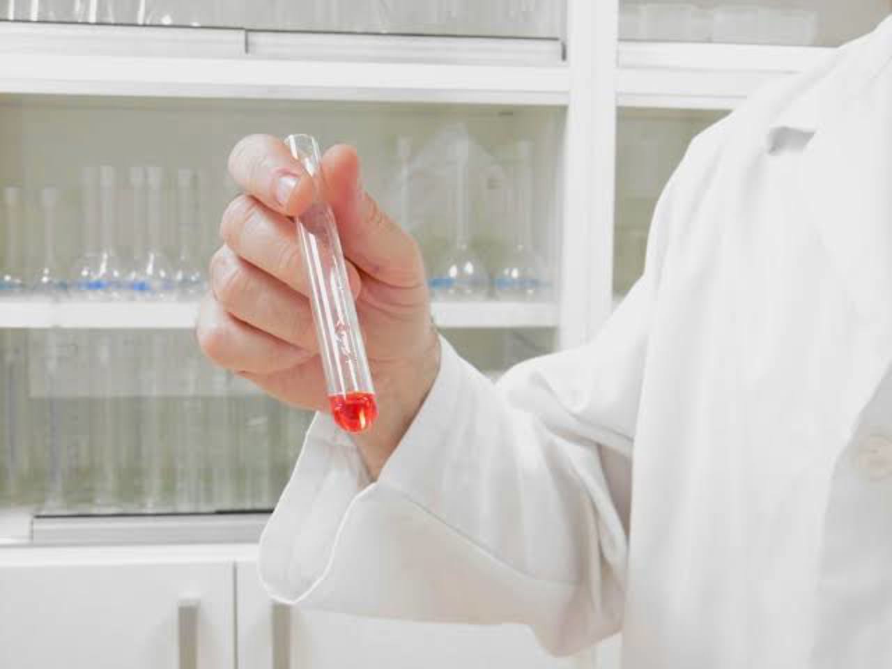 US monitors Siberian biosecurity incident after researcher death 
