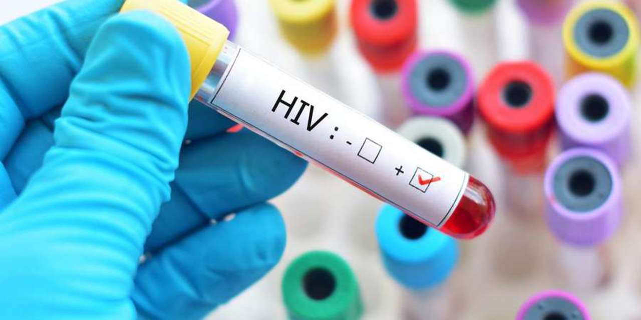 În 2024, în Republica Moldova au fost înregistrate 880 de cazuri noi de infectare cu HIV