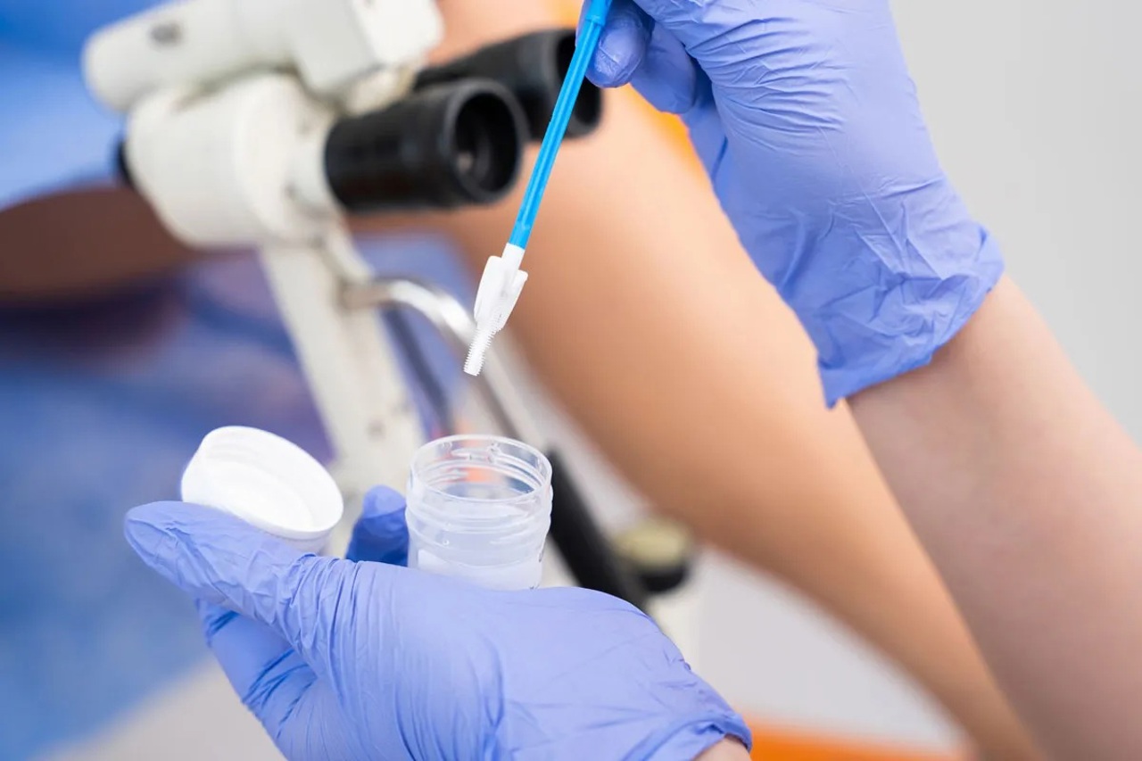 În fiecare an, 160 de femei decedează de cancer de col uterin. Medic: „Regretabil pentru o țară unde testul Papanicolau este gratuit” 