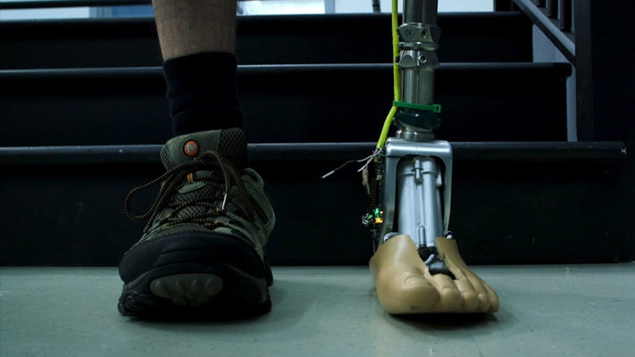 Breakthrough Prosthetic Restores Touch and Temperature Sensation