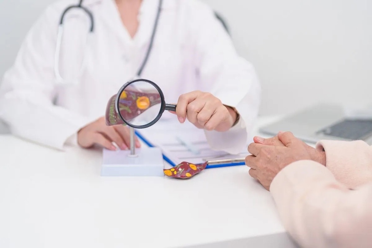 Medic: Hepatita netratată poate duce la ciroză în circa zece ani 