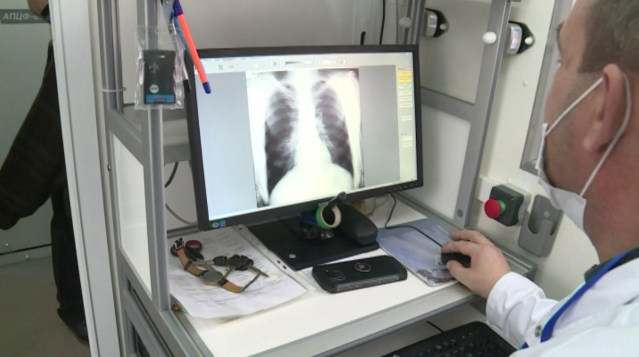 Medic: Complicațiile severe cresc riscul de deces în pneumonia netratată la timp