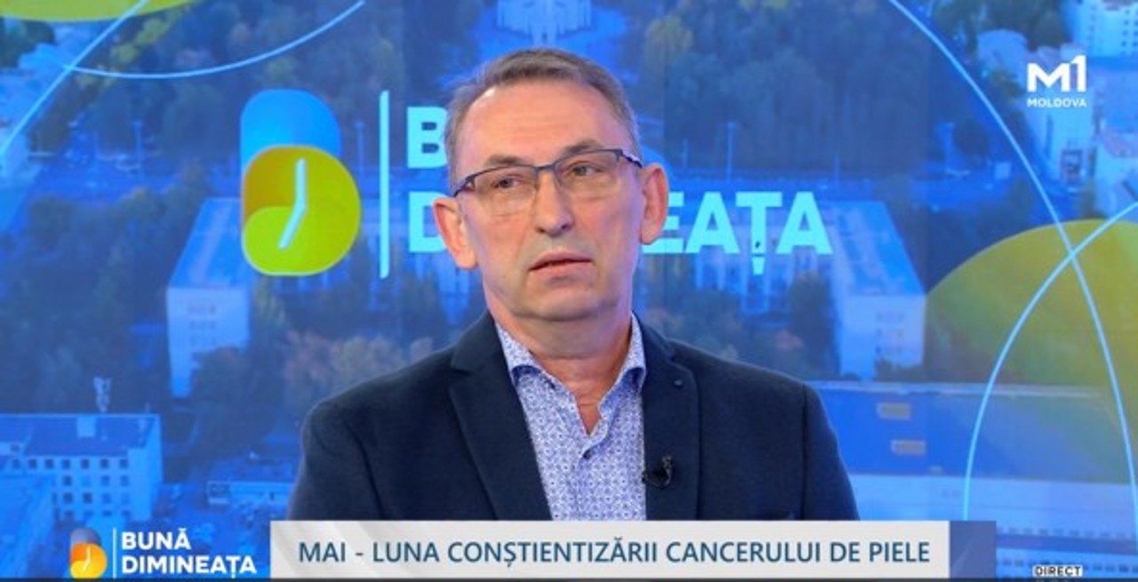 Numărul cazurilor de cancer de piele, în creștere în R. Moldova. Medic: „Duce la schilodiri, uneori la decese”