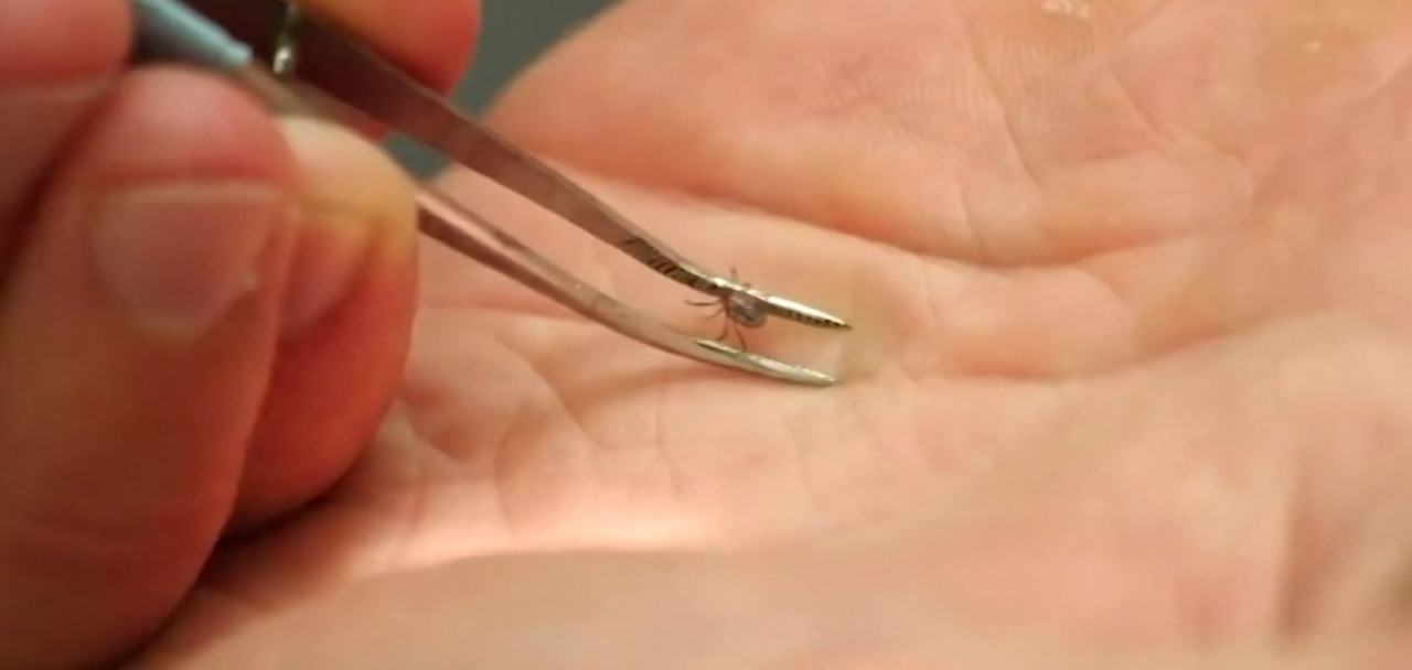 Hidden danger: Tick bites can cause serious illness