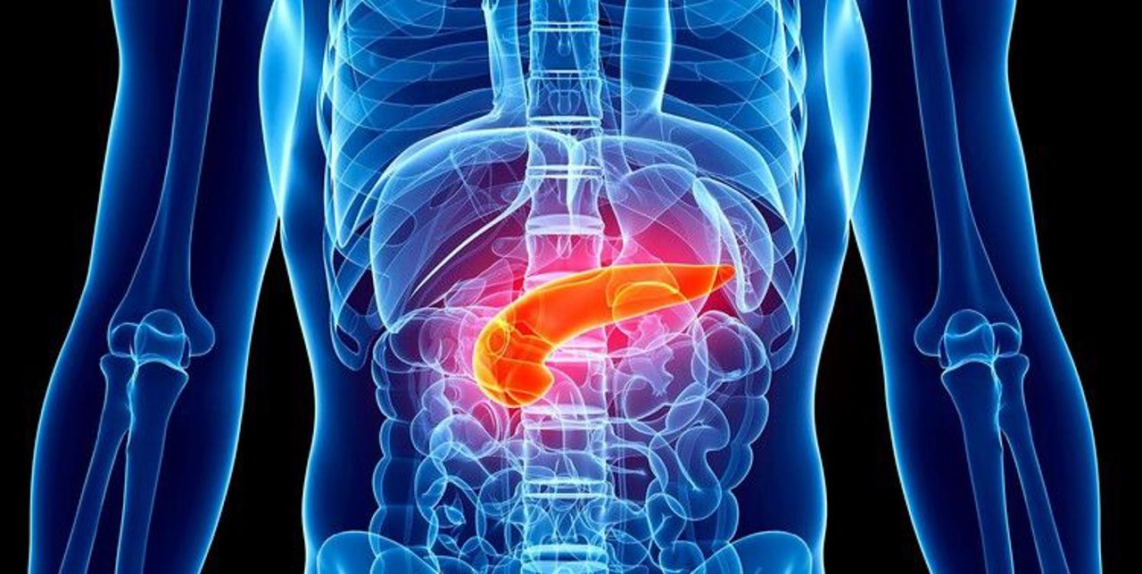 Pancreasul gras: O afecțiune asimptomatică care poate avea complicații grave