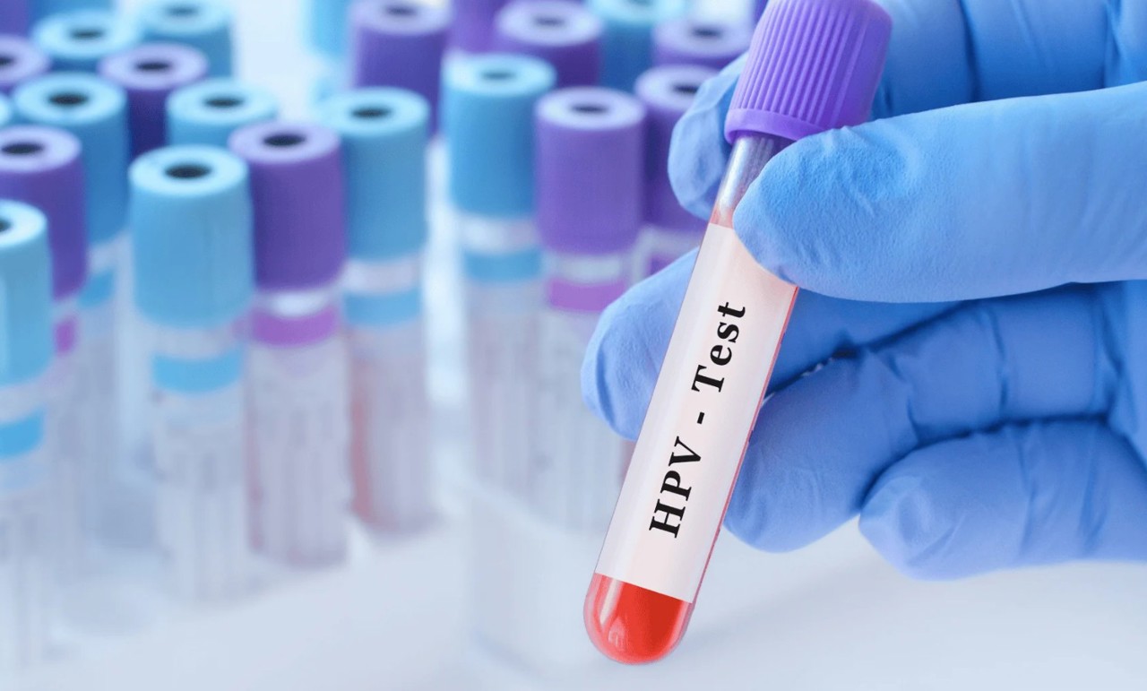 R. Moldova testează o nouă metodă de depistare a cancerului de col uterin. Peste 3.000 de femei au participat la proiectul-pilot